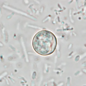 Microscopy wet mount image of Cyclospora cayetanensis oocysts