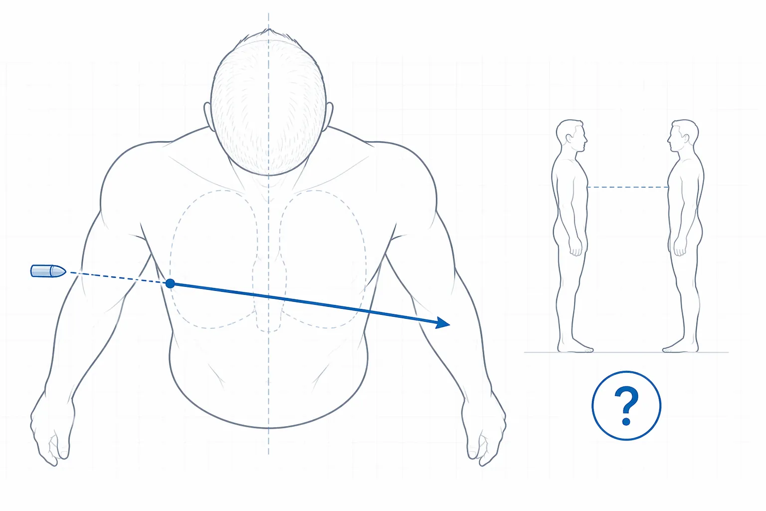 Forensic diagram showing a bullet path from left to right, front to back, and downward