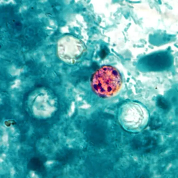 Microscope photograph of stained Cyclospora cayetanensis oocysts